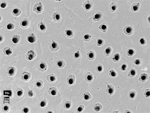 Microscopic view of open dentin tubules in human tooth structure, showing porous surface responsible for tooth sensitivity.